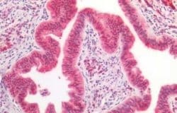 CCDC6 Antibody, Novus Biologicals 50 &mu;g | Buy Online | Novus Biologicals | Fisher Scientific